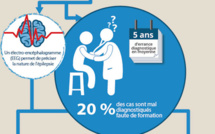 L'épilepsie touche 500 000 personnes en France